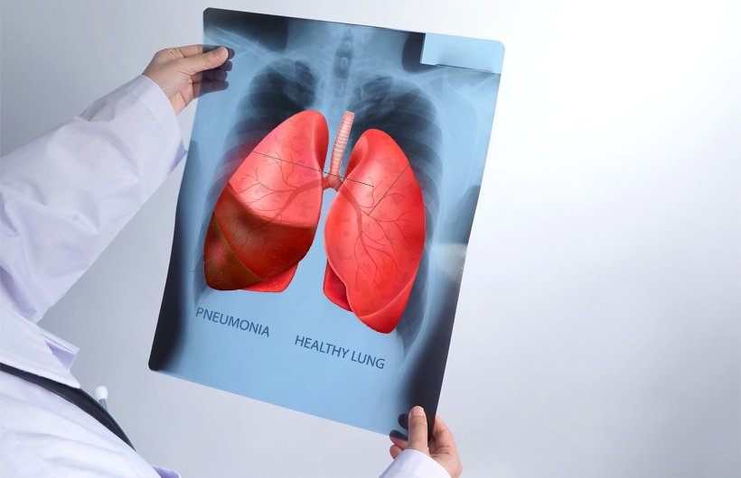 TB Specialist Doctor in Hyderabad Dr Kunal Waghray