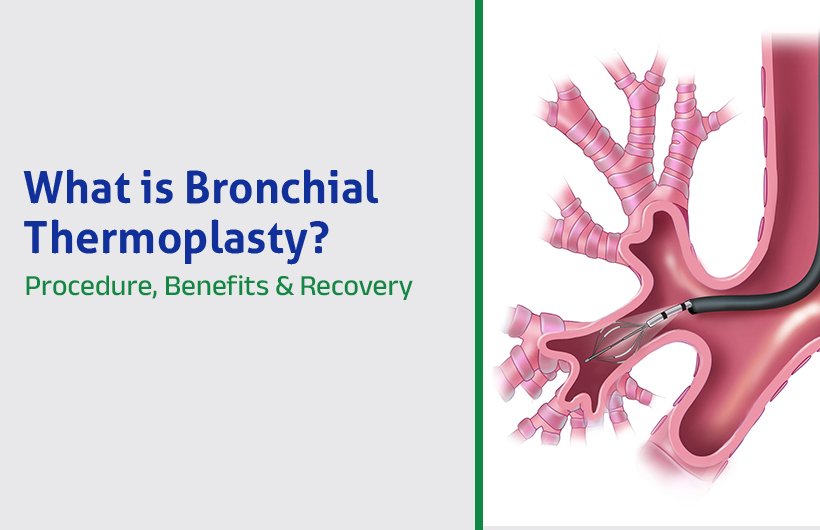 Bronchoscopy doctor in Hyderabad