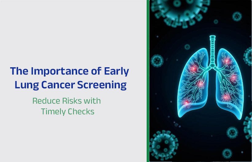 Early Lung Cancer Screening