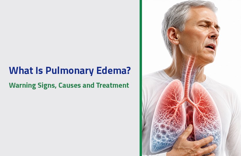 Pulmonary Edema Causes and Symptoms