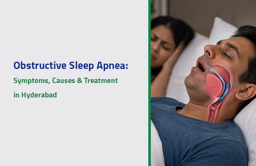 Obstructive Sleep Apnea