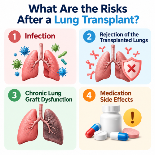 Lung Transplant